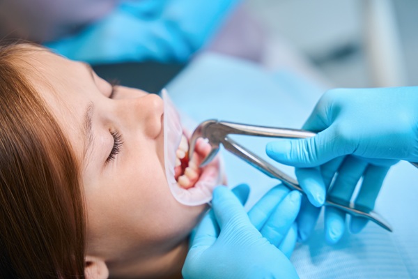 How Tooth Extractions Impact Other Teeth